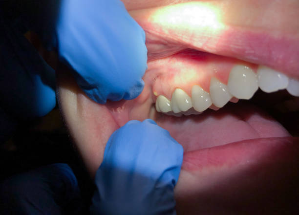 Best Emergency Dentist for Special Needs Patients in Pingree Grove, IL