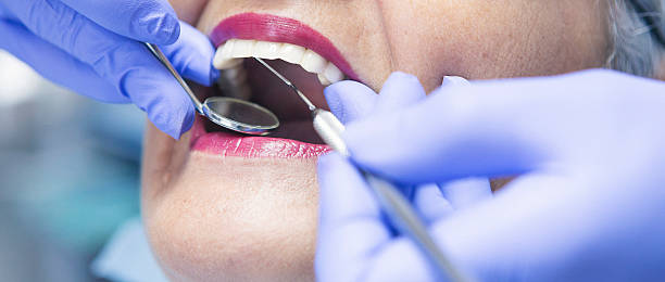 Best Mobile Emergency Dentist in Pingree Grove, IL